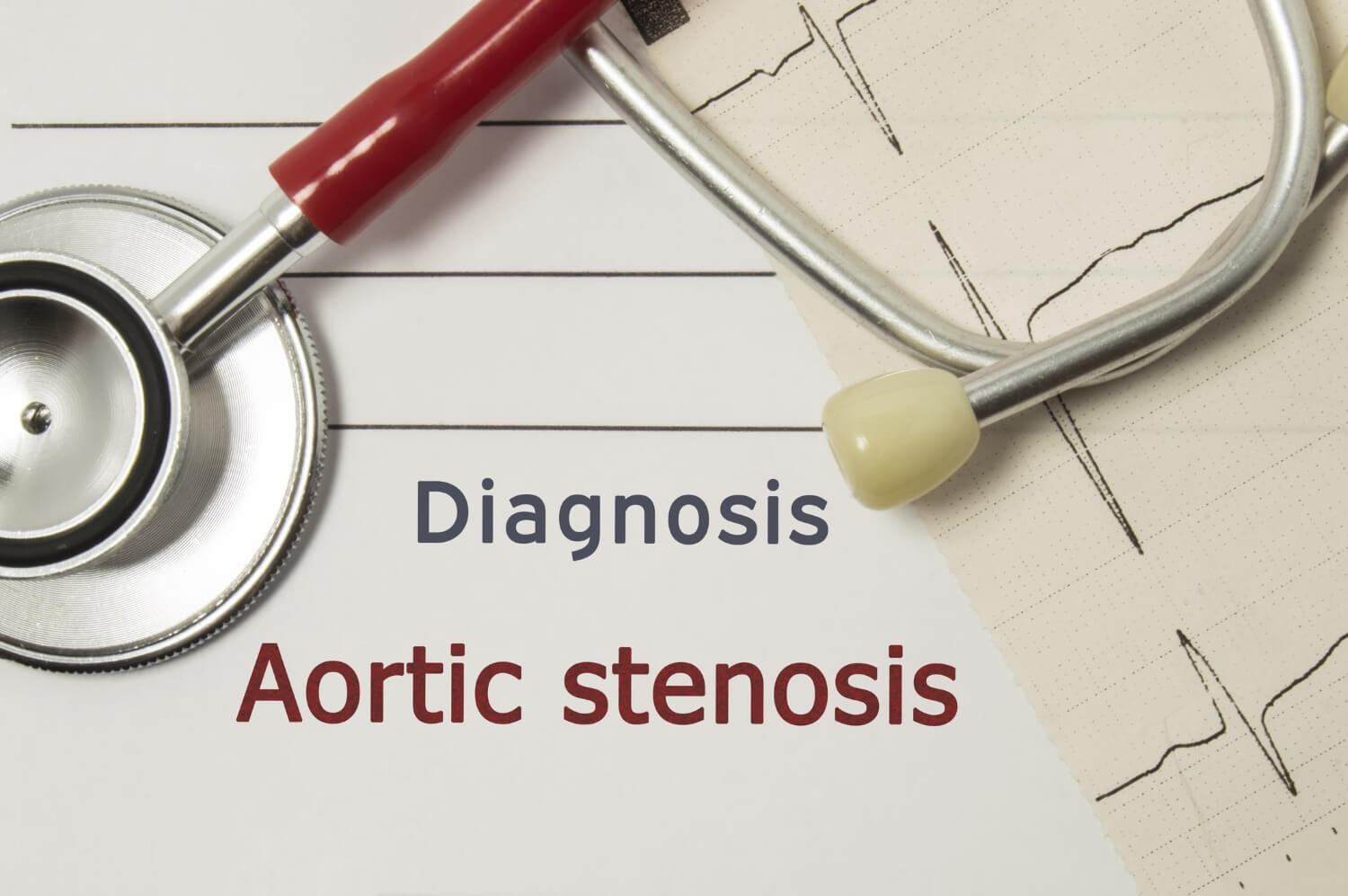 Aortic Valve Stenosis Symptoms And Causes Treatment For Aortic Stenosis