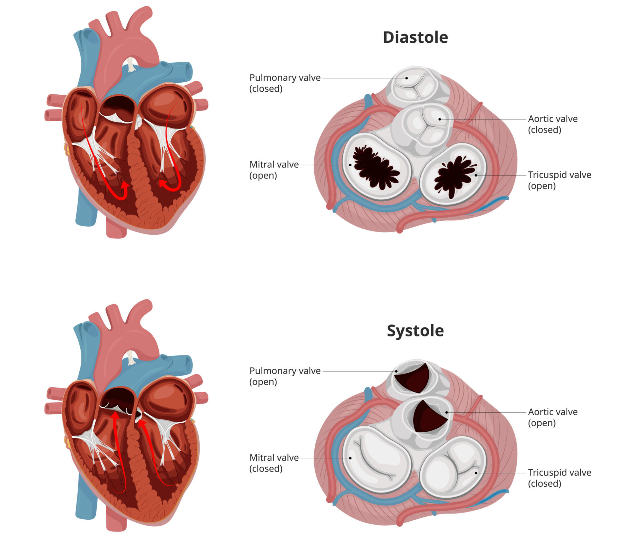 Surgery Aortic Valve Replacement, Aortic Valve Surgery